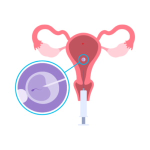Infertility & IVF Treatment