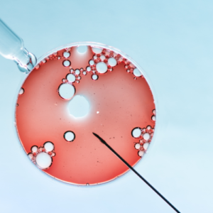 Hysteroscopy & Laparoscopy