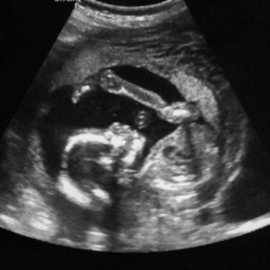 Obstetrics & Antenatal Care